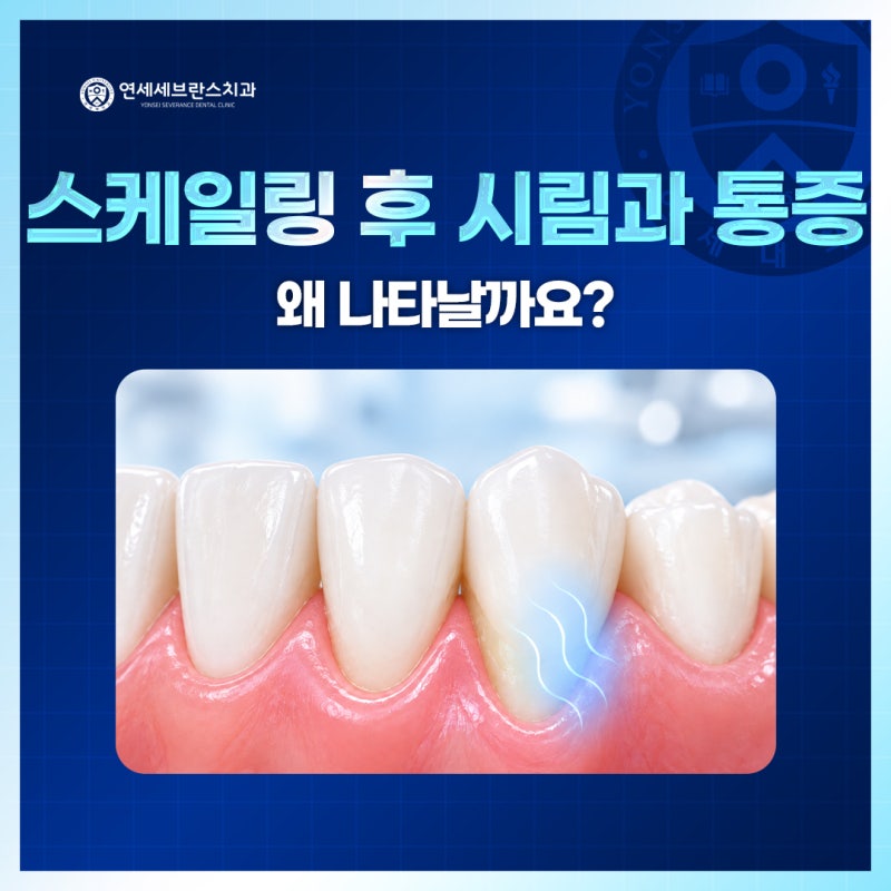 신대방치과 스케일링 후 시림과 통증, 왜 나타날까요?