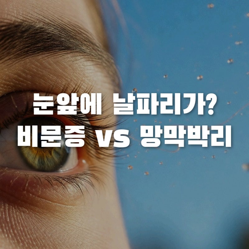 눈앞에 날파리? 비문증 증상과 망막박리 전조증상 구분법