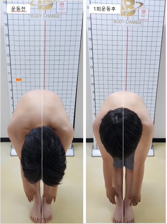 굽은어깨통증 굽은어깨교정운동, 등을 펴도 다시 말리는 이유