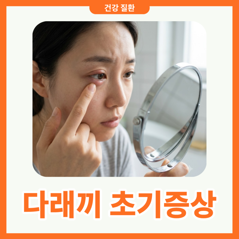 다래끼 초기증상 눈이 간질간질하고 붓기 시작했다면 확인할 것