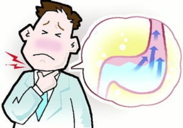 위내시경 정상인데 목이 타들어간다면? 비미란성 역류성 식도염에 대한 한약 치료 효과