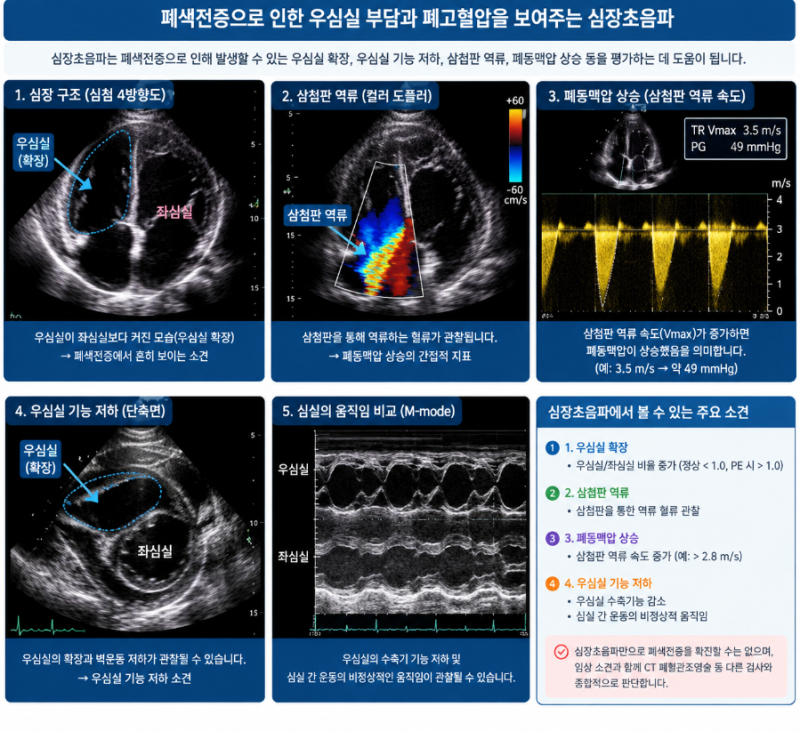 「수술·출산 후 발생할 수 있는 폐색전증, 원인부터 증상과 치료까지」
