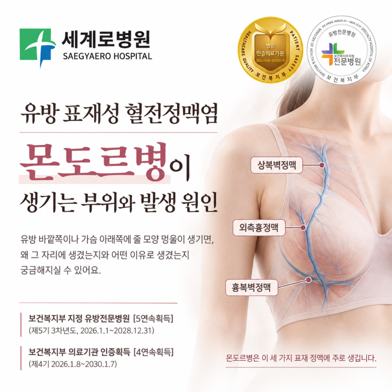 몬도르병이 생기는 부위와 발생 원인
