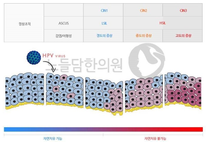 임신 중 자궁경부이형성증 추적관찰, 자연치유, 치료 및 출산방법 총정리