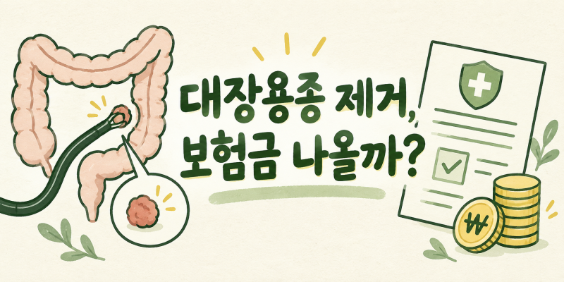 대장용종 제거했는데 보험금이 나온다고? 실비·수술비 청구 전 확인하세요