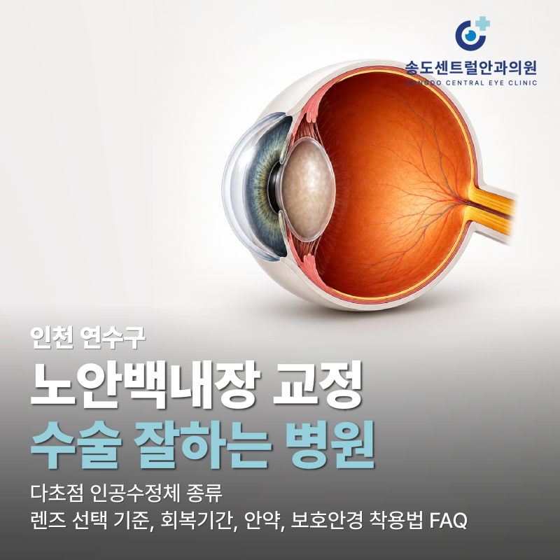 인천 연수구 노안백내장 교정 수술 잘하는 병원 - 다초점 인공수정체 종류, 렌즈 선택 기준, ....