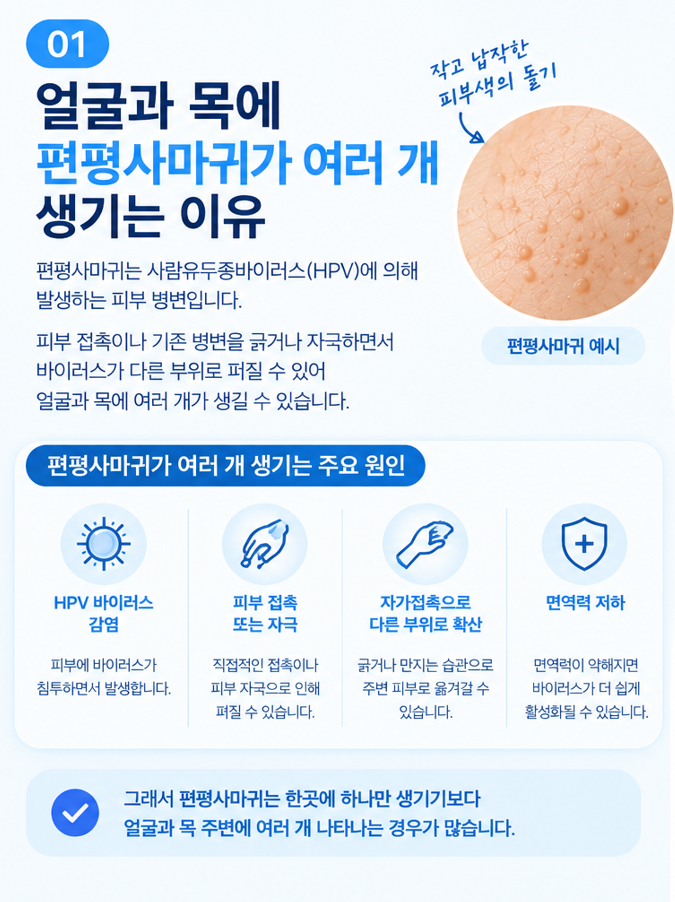 얼굴과 목에 편평사마귀가 여러 개 생기는 이유, 처음 발견했을 때 확인할 것