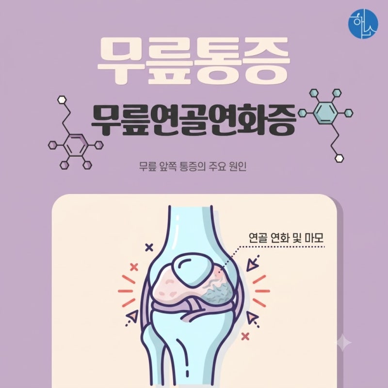 [ 망포 무릎통증 한의원] "무릎 앞쪽이 뻐근해요" 2030도 방심할 수 없는 연골연화증 증상