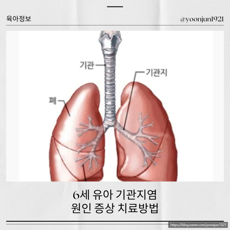 6세 유아 기관지염 원인 증상 관리 치료방법