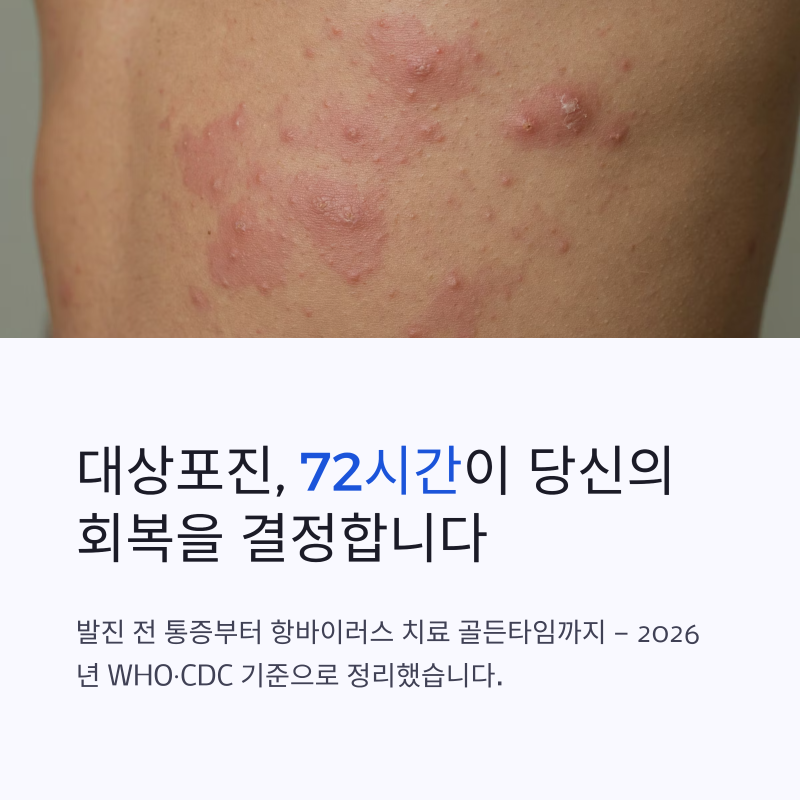 대상포진 원인 증상 초기 대응방법, 72시간이 중요한 이유