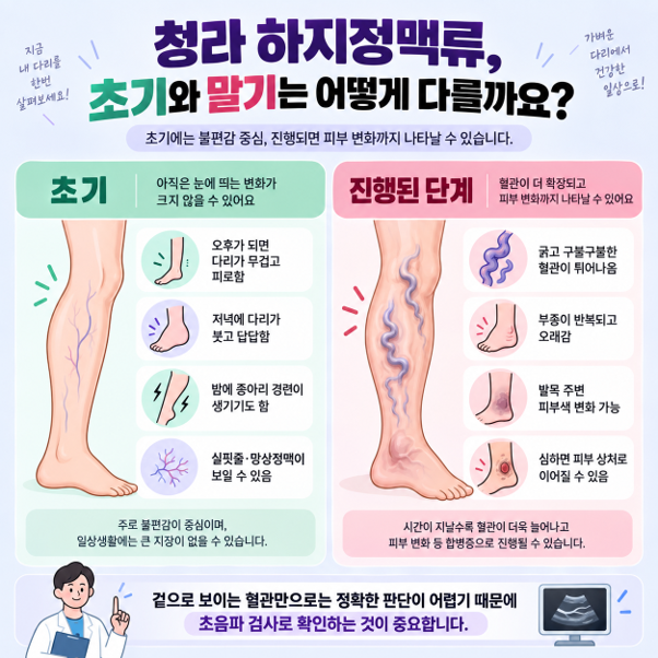 청라 하지정맥류, 초기와 말기는 어떻게 다를까요?