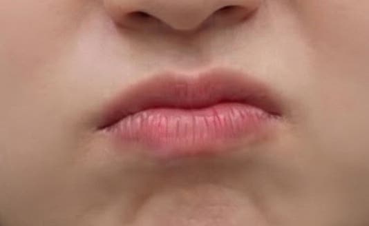 구안와사병원 급하게 알아보다 바를정한방병원 예약했어요