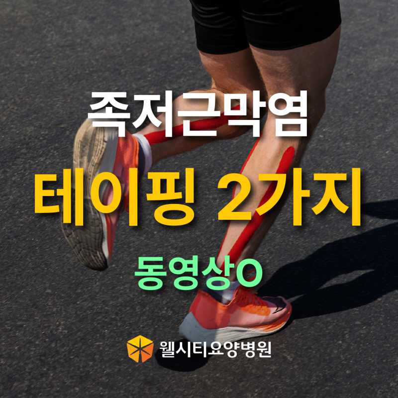 족저근막염 테이핑 방법, 로우다이·키네시올로지 테이핑 차이와 주의사항
