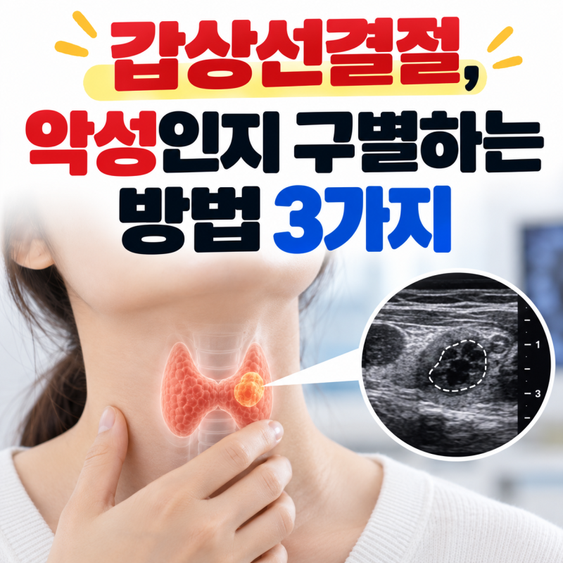 갑상선결절, 악성인지 구별하는 방법 3가지