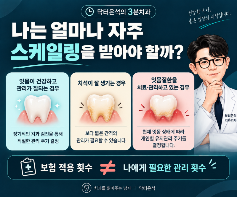 스케일링, 매년 받는데도 잘 모르셨죠? 보험·비용·주기 쉽게 읽어드립니다