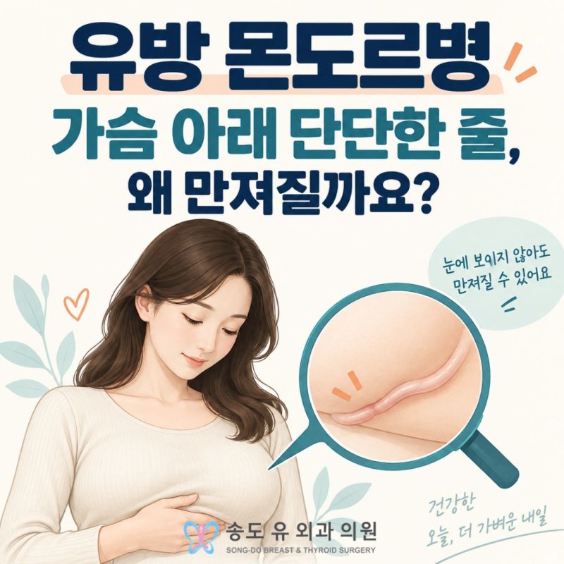 유방 몬도르병, 가슴 아래 단단한 줄이 만져지는 이유는?