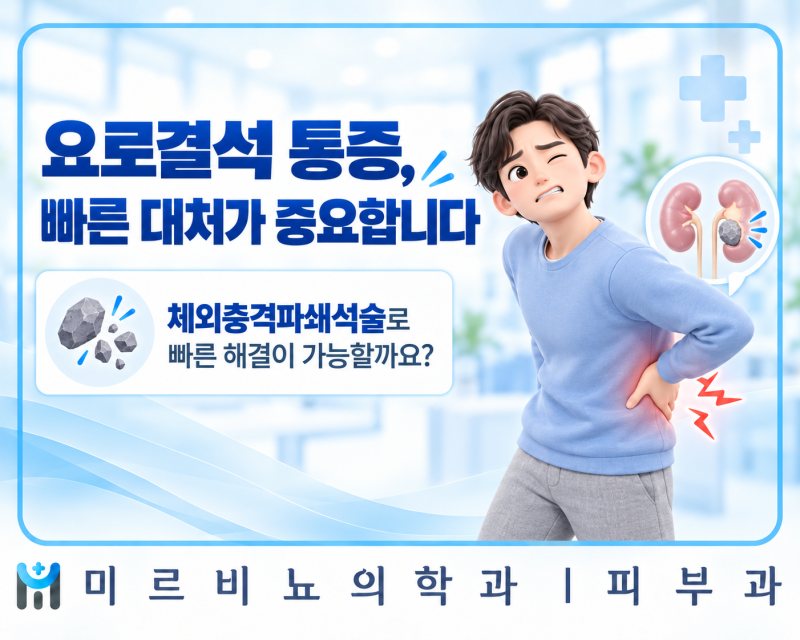 요로결석 통증, 체외충격파쇄석술로 빠른 해결