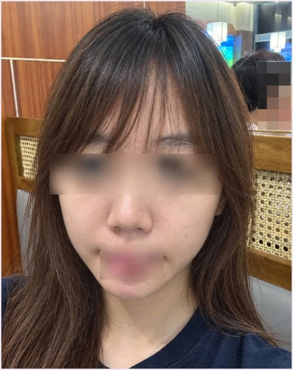 다낭성 난소 증후군 좋은 음식 6주차 분들