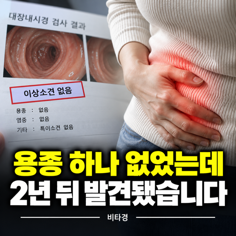 “용종 하나 없이 깨끗했는데…” 대장내시경 후 놓치면 안 될 신호 3가지