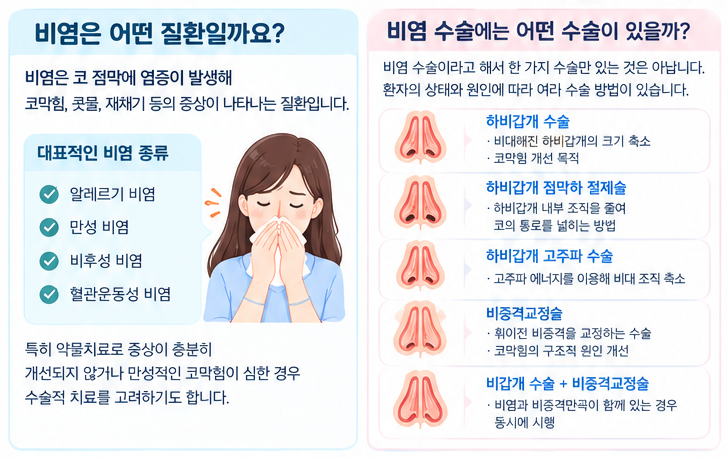 비염 수술 전, 꼭 확인해야 할 보험보장