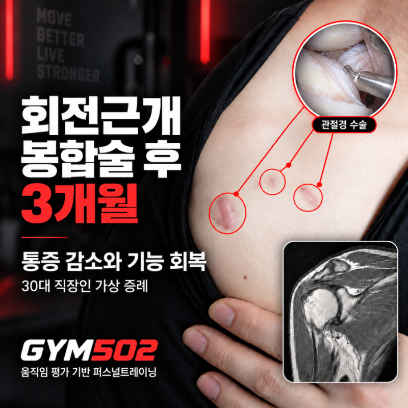 양산 30대 직장인의 회전근개파열 관절경 봉합술 후 3개월, ❗️기능 회복과 ❗️어깨통증 감....