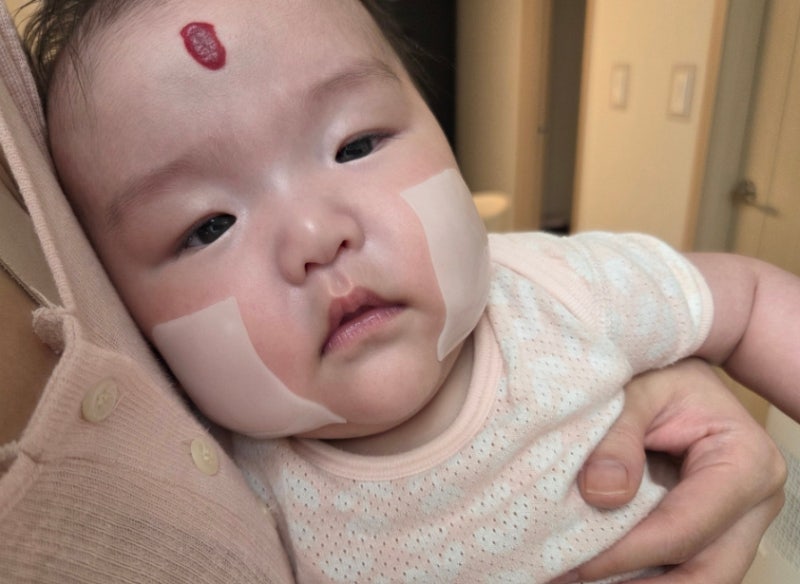 밤마다 긁는 아기 피부 가려움 진정템, 앙또미뇽 판테놀 아토 패치로 편안하게