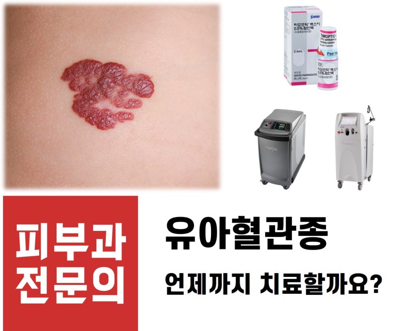 유아혈관종, 두세 번 치료했는데 왜 아직 그대로일까요?