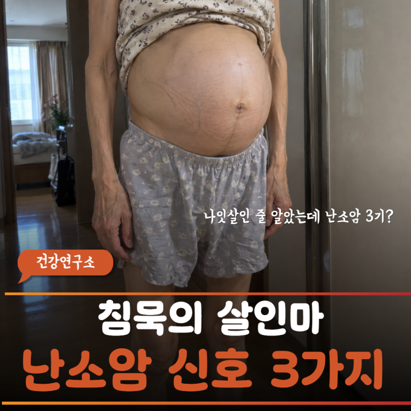 "폐경된 지 3년 지났는데 아랫배가 묵직.." 난소암 복수 증상과 골반 종양 신호 3가지