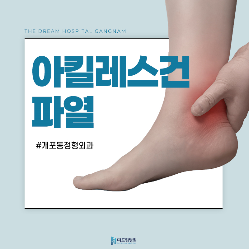 개포동정형외과, 뒤꿈치 ‘뚝’ 소리와 통증 아킬레스건 파열 확인