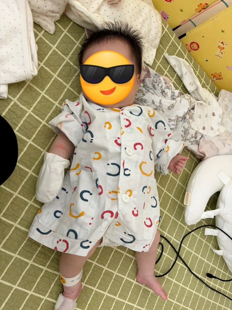 [혈관종치료] 40일 아기 강북삼성병원 당일 입원 후기 / 정혜림교수