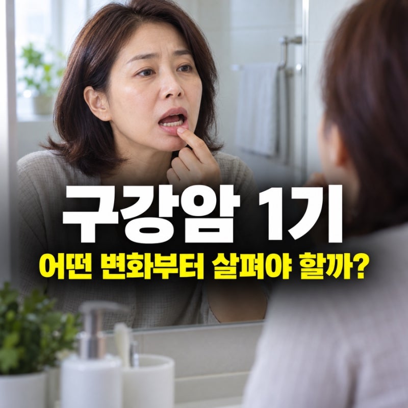 구강암 1기, 초기증상부터 수술·생존율까지 알아봐요