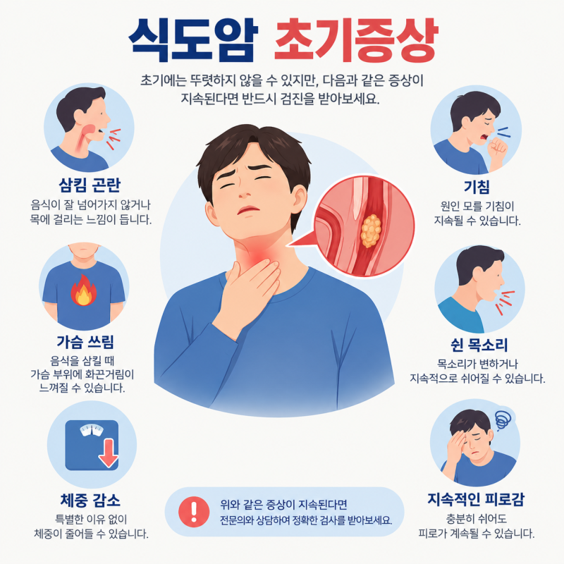 목에 이물감, 단순 역류성 식도염일까? 식도암 초기증상 자가진단 5가지