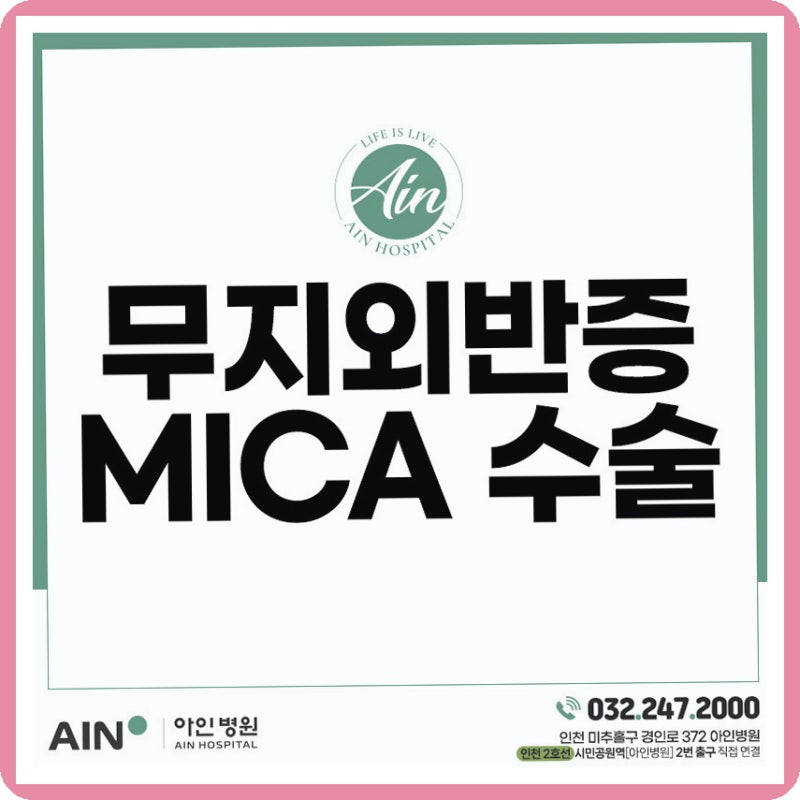 인천 주안 무지외반증 정형외과, 치료 시기를 미루다 생기는 발 변형의 단계