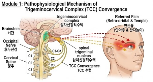 [의학 공부] 뒷머리 찌릿한 통증과 안구통의 실체: 경추성 두통 원인과 삼차신경경수핵(TCC) ....
