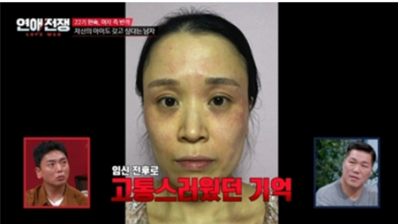 서장훈 “이건 아닌 것 같다”…16기 광수, 22기 현숙 임신 관련 발언 현재 쟁점