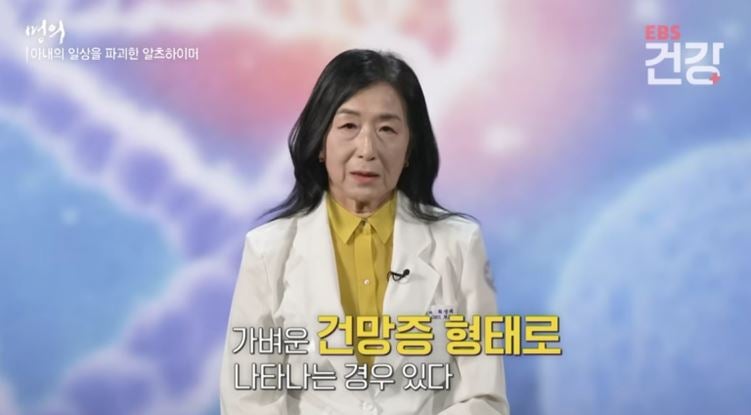 [명의 시리즈 #63] 알츠하이머 치매 치료 명의, 최성혜 교수
