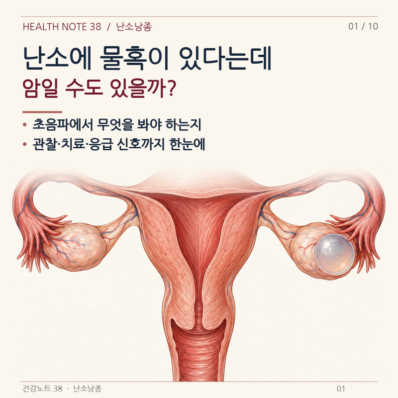 초음파에서 난소에 물혹이 있다는데, 암일 수도 있을까?