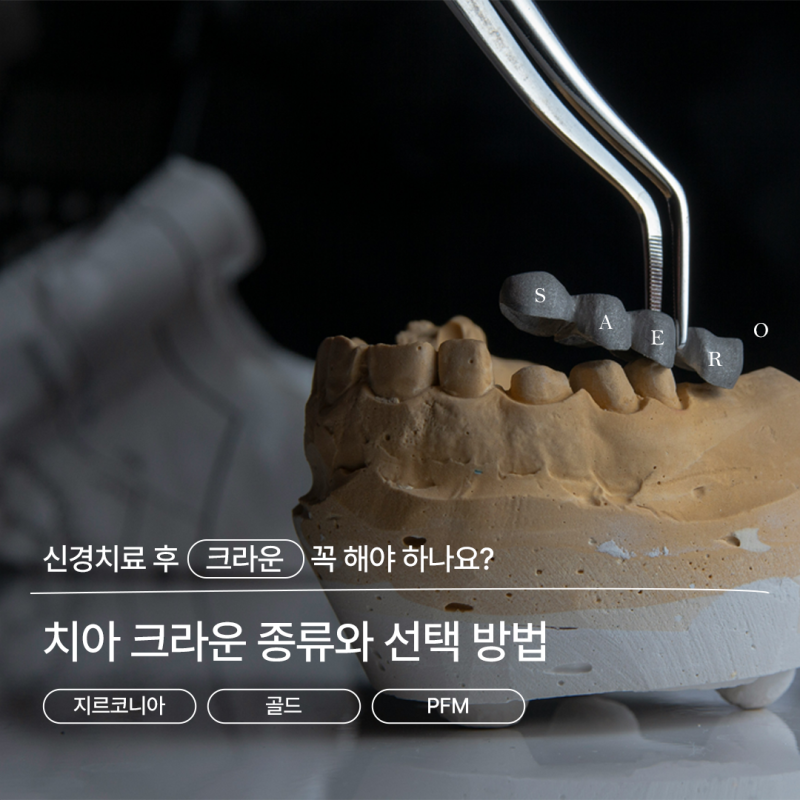 치아크라운, 신경치료 후 꼭 해야 하나요? 종류와 선택 방법까지