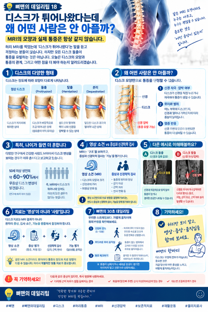 뼈맨의 데일리팁 ⑱디스크가 튀어나왔다는데, 왜 어떤 사람은 안 아플까?
