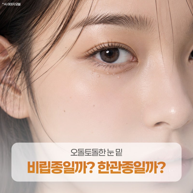 광안동피부과 오돌토돌한 눈 밑 비립종 or 한관종