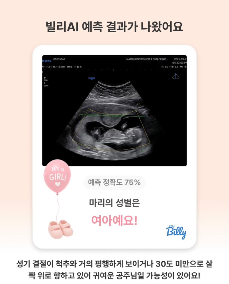 임신12주차 임산부(feat. 성별, 각도법, 사마귀태몽)