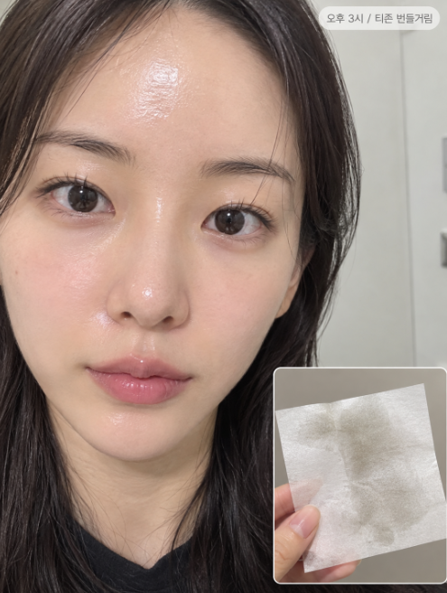 [가격공유] 블랙헤드, 코피지 강남 근처 피부과 손품판 가격 공유 : 아그네스 골드PTT 포텐자 ....
