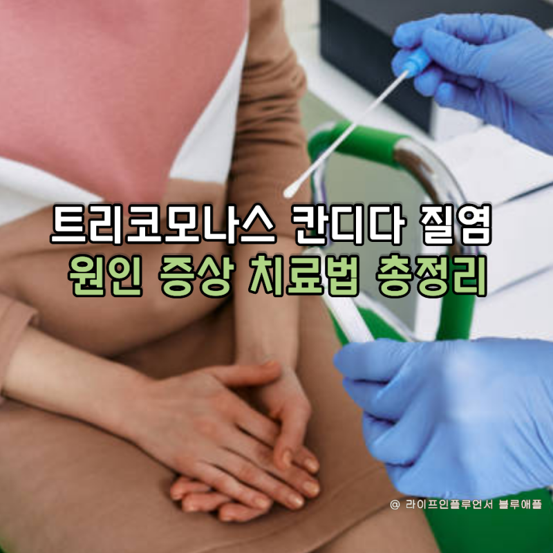 트리코모나스 칸디다 질염 원인 증상 치료법 총정리