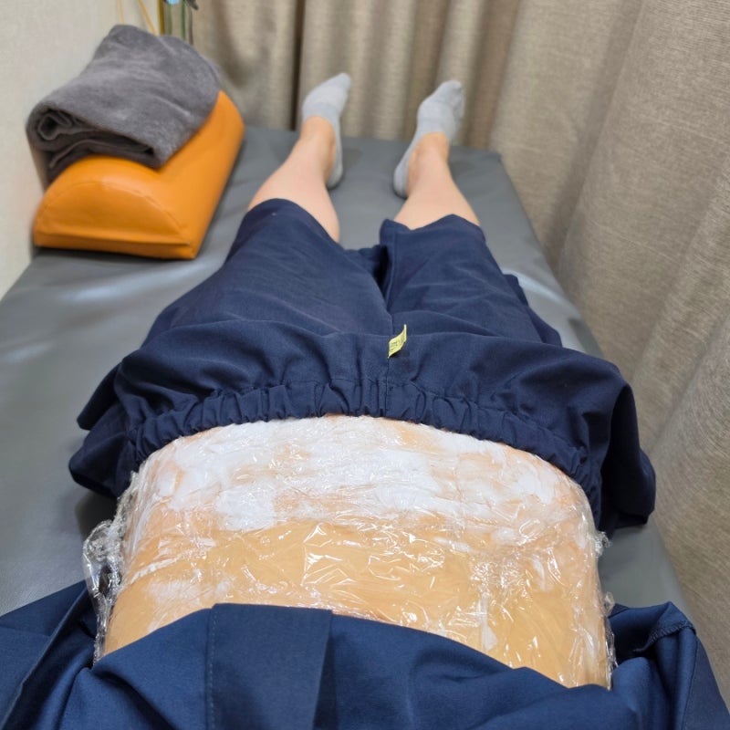 닥터편사 명성한의원 부천 아랫배 편평사마귀 제거 후기