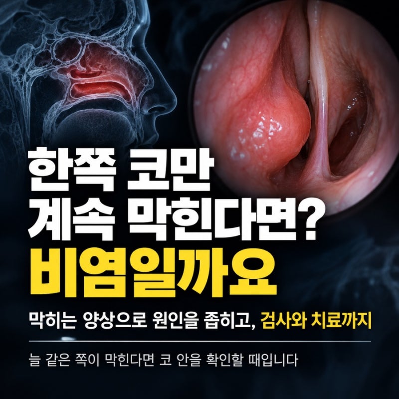 한쪽 코만 계속 막힌다면? 비염일까요 막히는 양상으로 원인을 좁히고, 검사와 치료까지