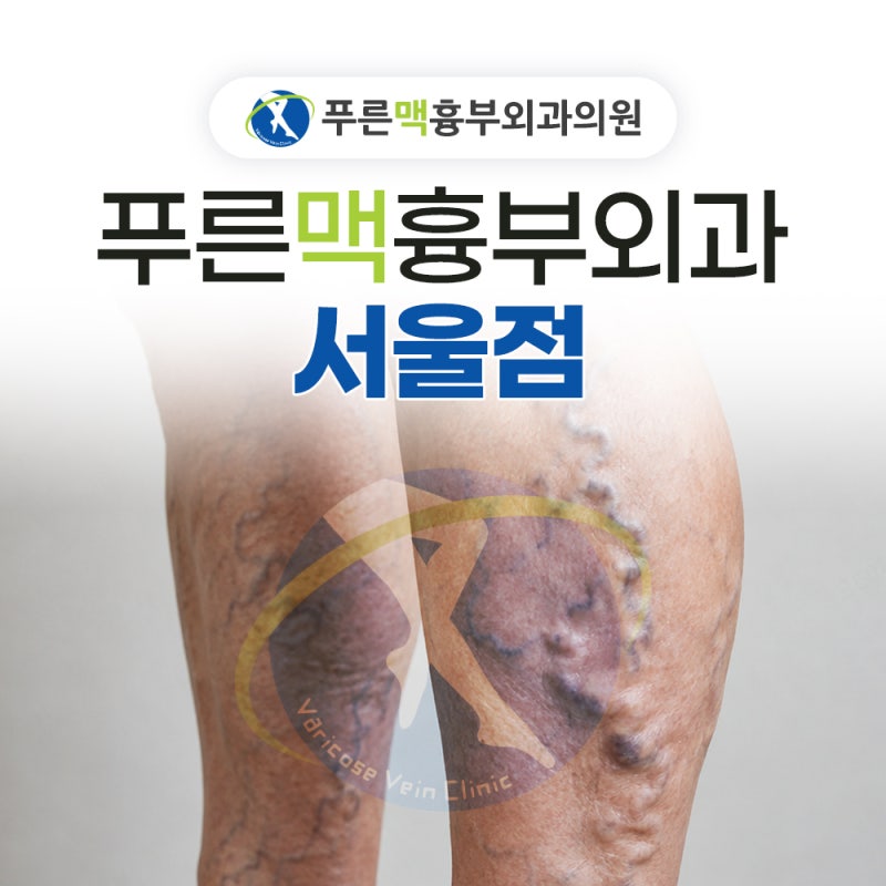 서울 하지정맥류 병원 추천, 혈관을 제대로 보는 곳의 특징 3가지