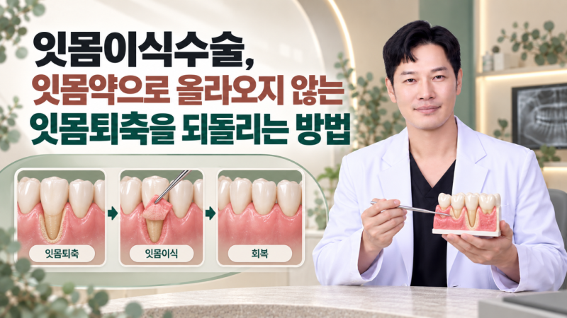잇몸이식수술 후기, 잇몸약으로 올라오지 않는 잇몸퇴축을 터널링 잇몸이식으로 되돌린 3가....