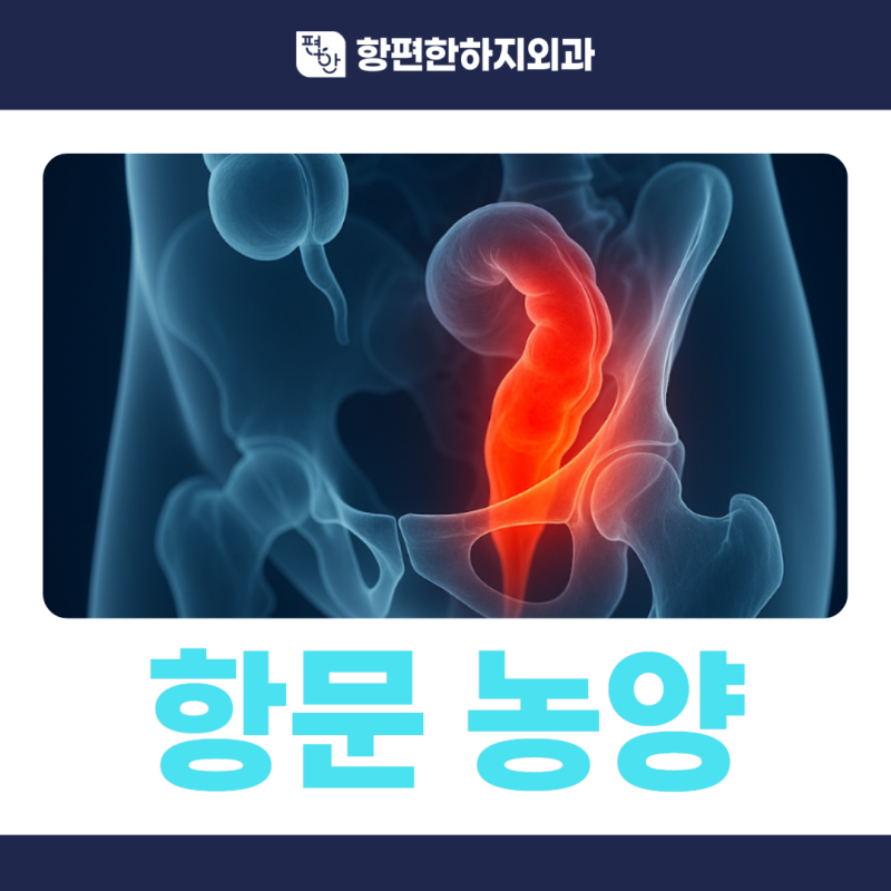 항문 옆이 붓고 열감이 느껴진다면 노원항문농양 가능성