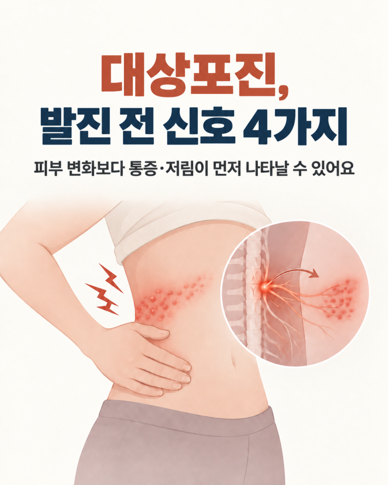 대상포진 증상, 발진 전 나타나는 초기증상 4가지