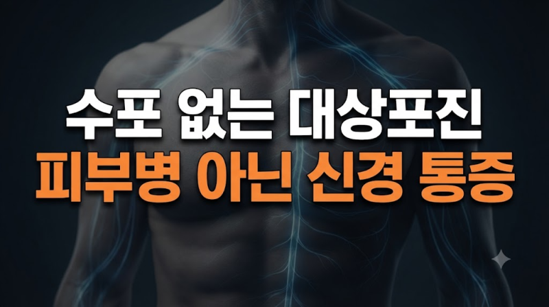 대상포진 수포 없는 통증 초기 증상과 원인, 구별하는 방법 총정리